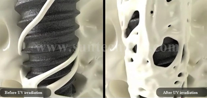 UV-irradiated implants can quickly promote bone growth