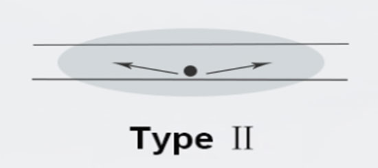 Type II Type II